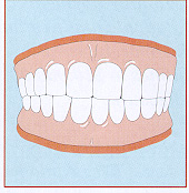 dentures.jpg (25289 bytes)