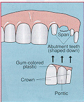 fpp.jpg (33108 bytes)