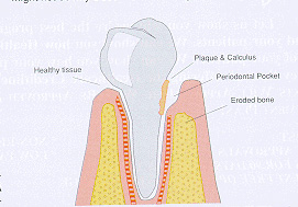 perio.jpg (30808 bytes)